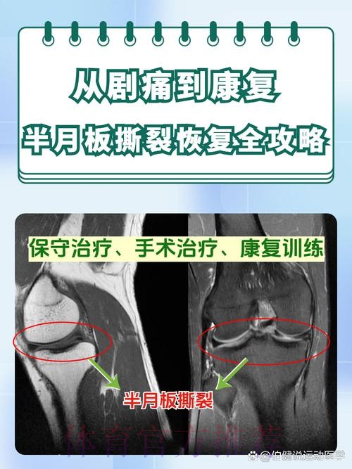 再受重伤!官方:米利唐十字韧带完全撕裂 半月板受伤